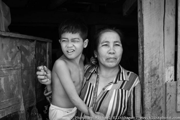 Boy in Cambodia with eye problems_klinkhamerphoto